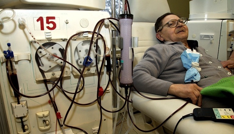 Leállhatnak a vesék, pedig sokan csinálják – 10 dolog, amit jobb, ha elkerülsz