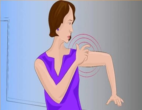 Így érzi magát az ember közvetlenül a stroke előtt a neurológus szerint