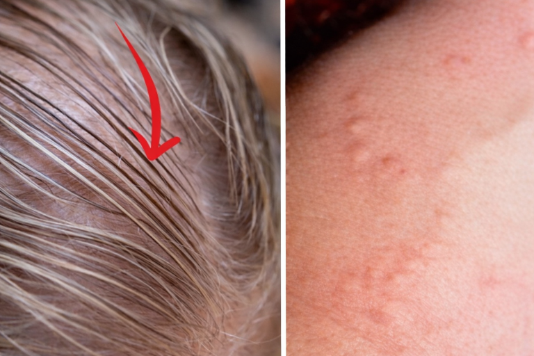 A pajzsmirigyprobléma 11 rejtett jele, amiről szinte senki sem vesz tudomást!