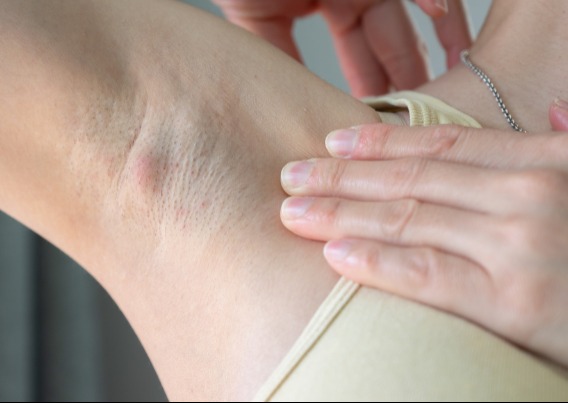 A daganat különleges jelei, amiket nehéz felismerni!