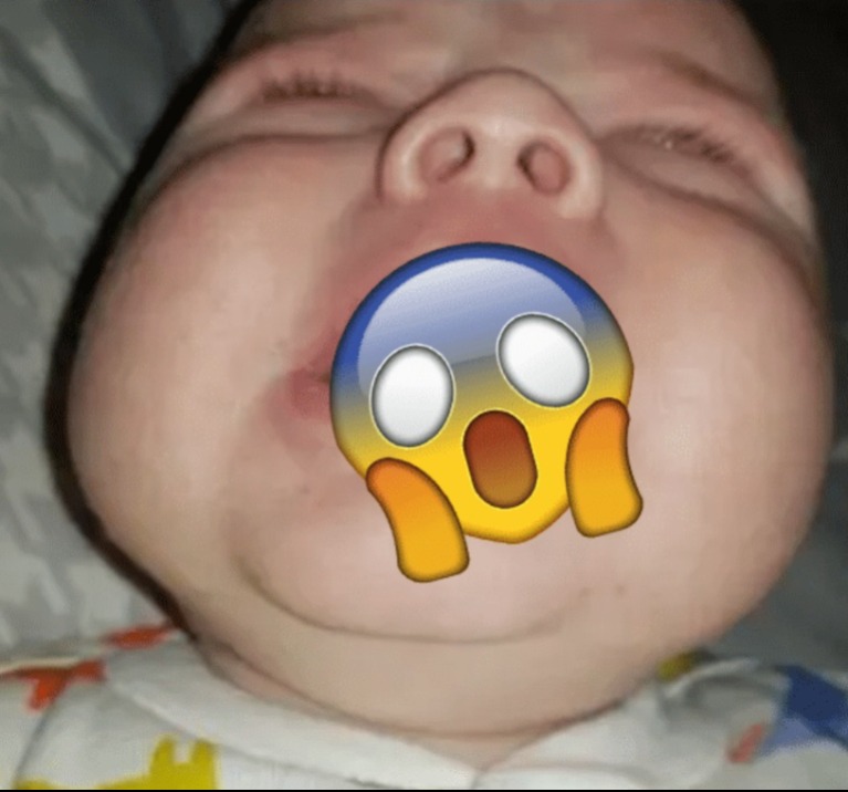 Különös dolog kezdett el nőni egy csecsemő szájában. Az orvosok még sosem láttak ilyet