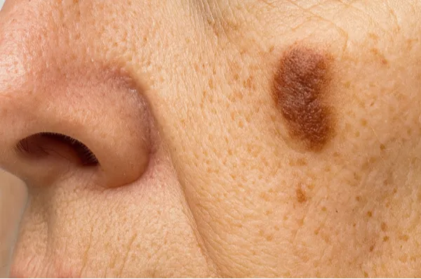 7 tünetmentes betegség, ami rövid időn belül végez az emberrel