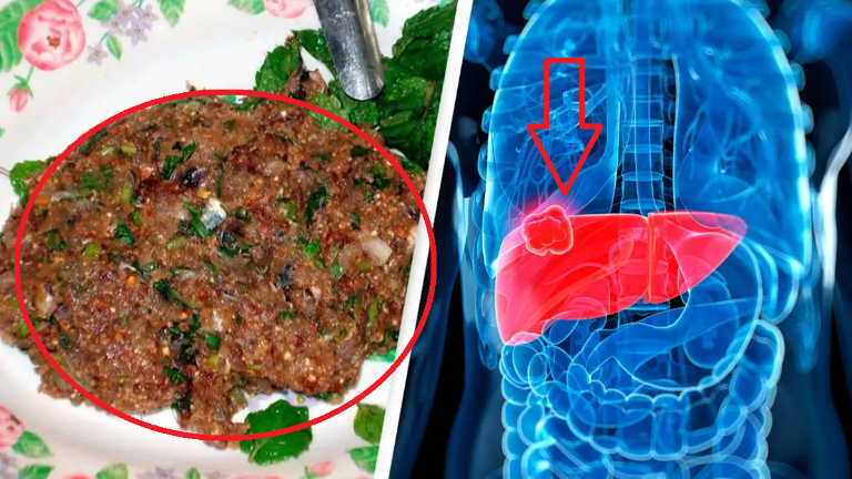 Ez az általunk kedvelt étel lehet a rák oka?