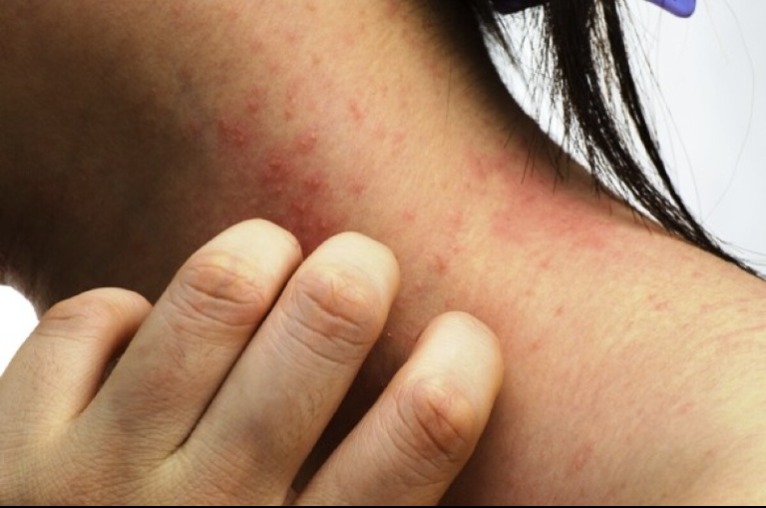 Azonnal fordulj orvoshoz, ha ezeket a tüneteket tapasztalod