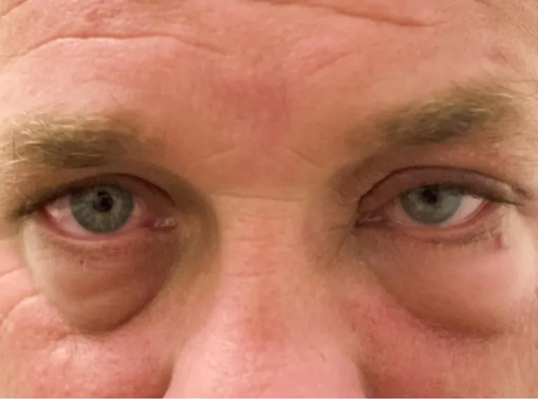 10 jel, hogy a veséid nem működnek megfelelően