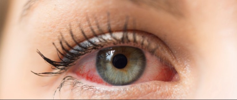 Észrevétlenül teszi tönkre minden szervedet, ha erre a betegségre nem figyelsz oda