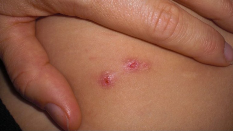 Igazi csodaszer a kövirózsa, sokan mégsem tudnak róla