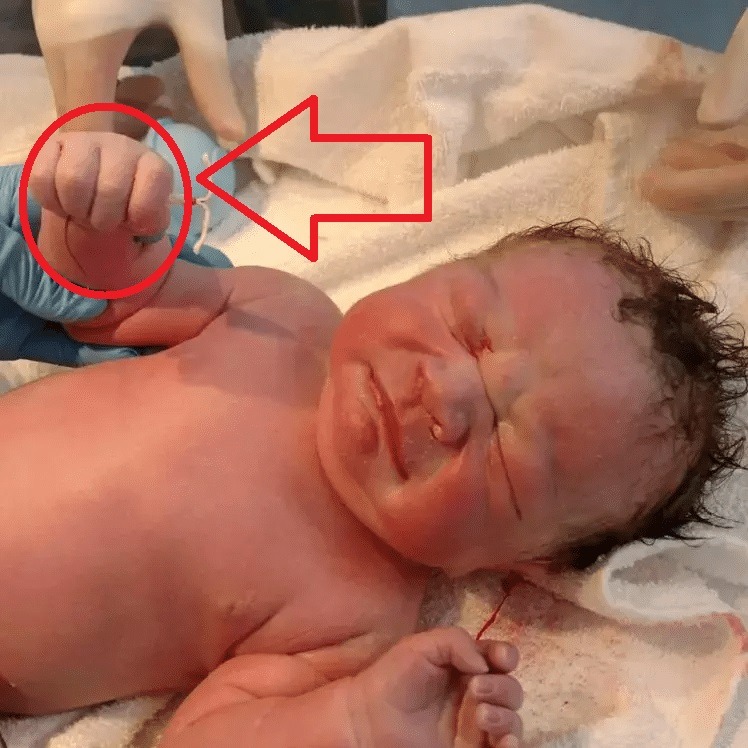 Furcsa tárggyal a kezében született a kisbaba! Az orvosok azonnal lefotózták!