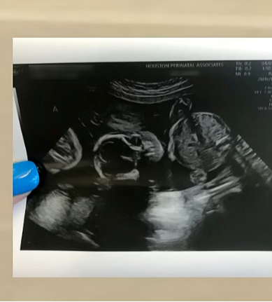 Három gyerekük volt, szerettek volna még egy babát. Elhűltek, amikor meglátták az ultrahang felvételt